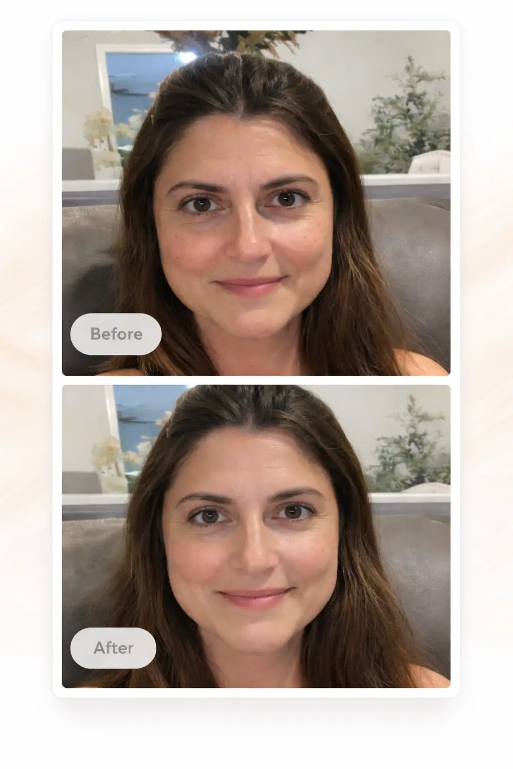 AI aesthetic preview before and after